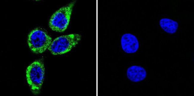 Phospho-CaMKII alpha (Thr286) Antibody in Immunocytochemistry (ICC/IF)