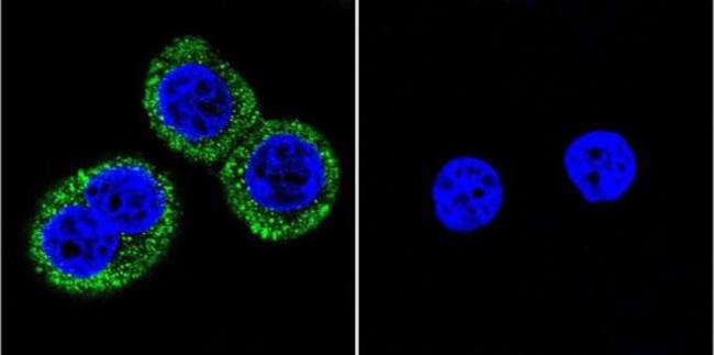 Phospho-CaMKII alpha (Thr286) Antibody in Immunocytochemistry (ICC/IF)