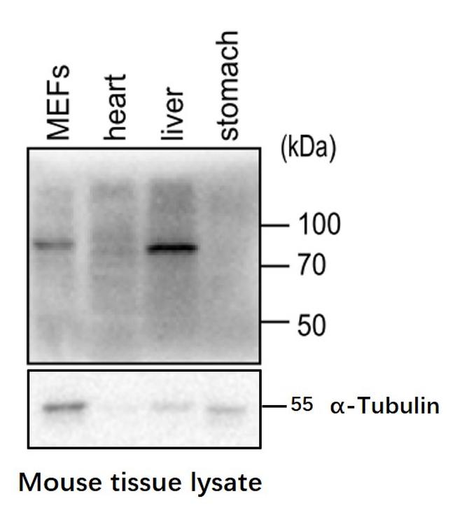 Phospho-GYS1 (Ser641, Ser645) Antibody in Western Blot (WB)