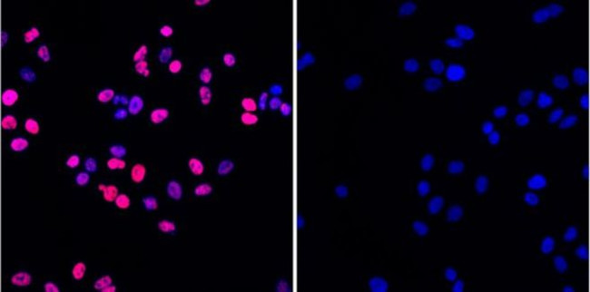 Phospho-Histone H2A.X (Ser139) Antibody in Immunocytochemistry (ICC/IF)