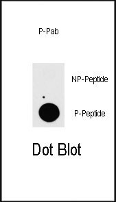 Phospho-TAB1 (Ser423) Antibody in Dot Blot (DB)