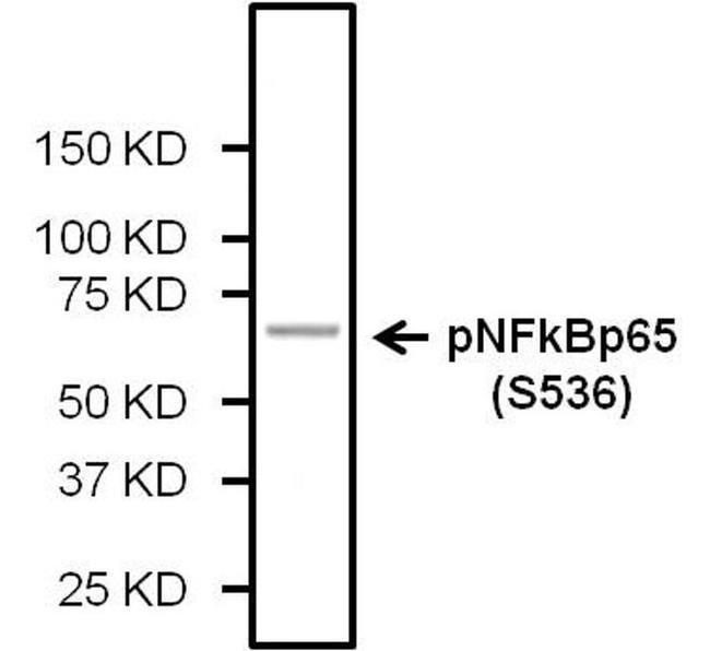 Phospho-NFkB p65 (Ser536) Antibody in Western Blot (WB)