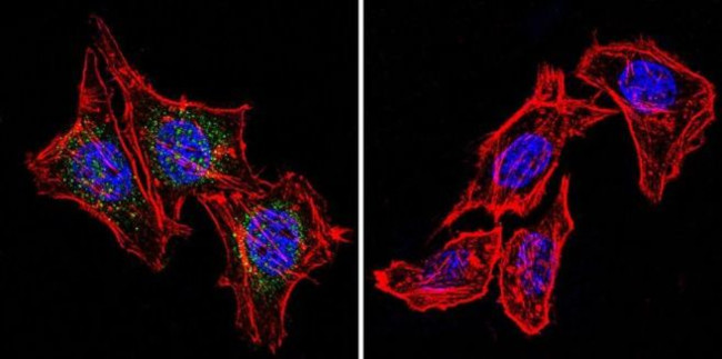 Phospho-Progesterone Receptor (Ser294) Antibody in Immunocytochemistry (ICC/IF)