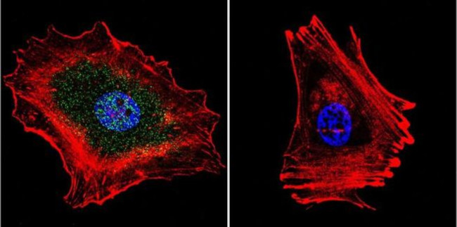 Phospho-Progesterone Receptor (Ser294) Antibody in Immunocytochemistry (ICC/IF)