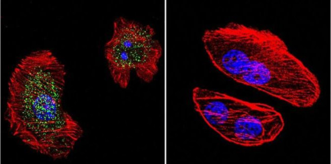 Phospho-Progesterone Receptor (Ser294) Antibody in Immunocytochemistry (ICC/IF)