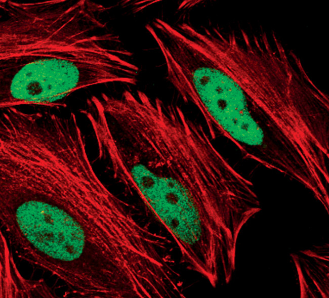 Phospho-c-Jun (Ser63) Antibody in Immunocytochemistry (ICC/IF)