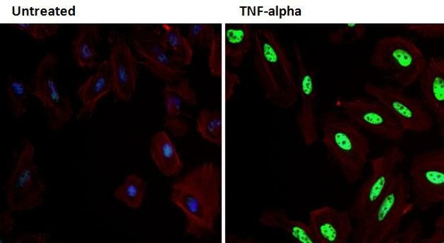 Phospho-p38 MAPK (Thr180, Tyr182) Antibody in Immunocytochemistry (ICC/IF)