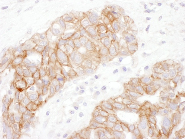 Plakoglobin Antibody in Immunohistochemistry (IHC)