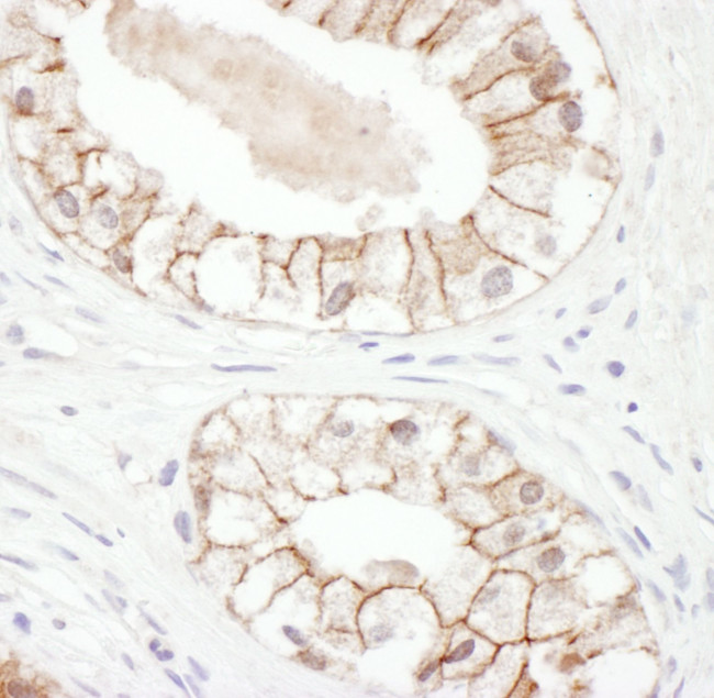 Plakoglobin Antibody in Immunohistochemistry (IHC)