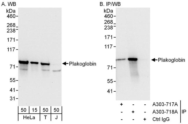 Plakoglobin Antibody in Western Blot (WB)