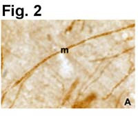 PLP1 Antibody in Immunocytochemistry (ICC/IF)