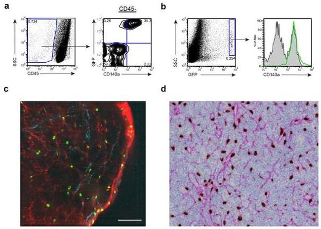 Podoplanin Antibody in Immunohistochemistry (IHC)