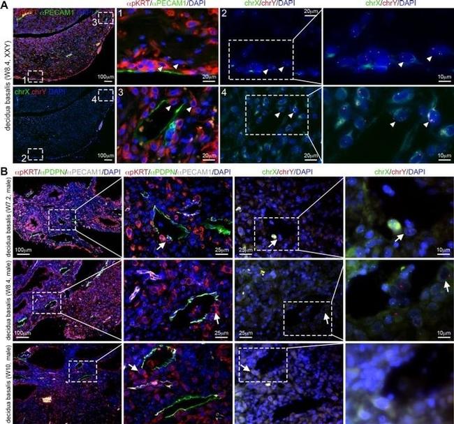 Podoplanin Antibody in Immunocytochemistry (ICC/IF)