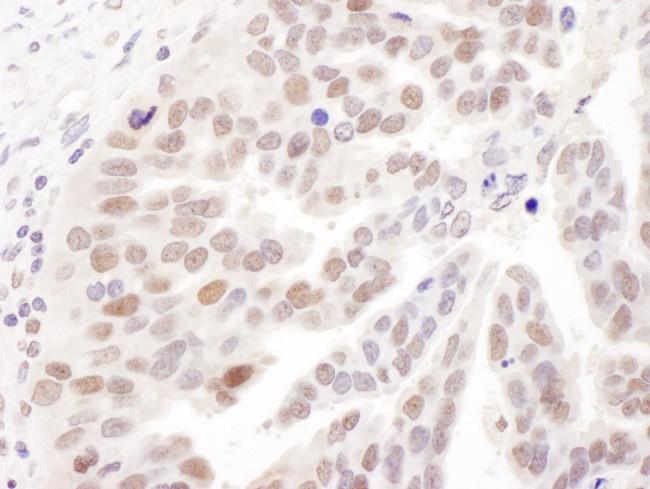 PolD1 Antibody in Immunohistochemistry (IHC)