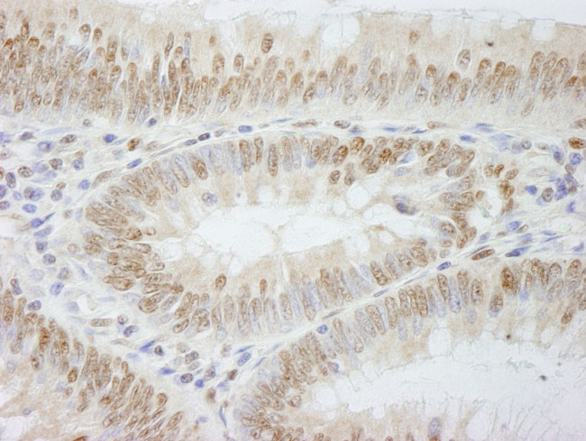 PolE3/p17 Antibody in Immunohistochemistry (IHC)