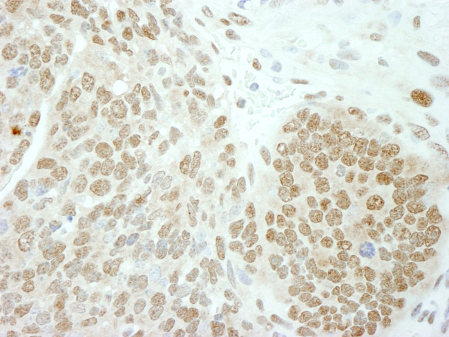 PolE3/p17 Antibody in Immunohistochemistry (IHC)