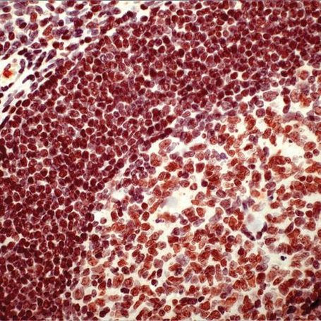 PARP1 Antibody in Immunohistochemistry (Paraffin) (IHC (P))