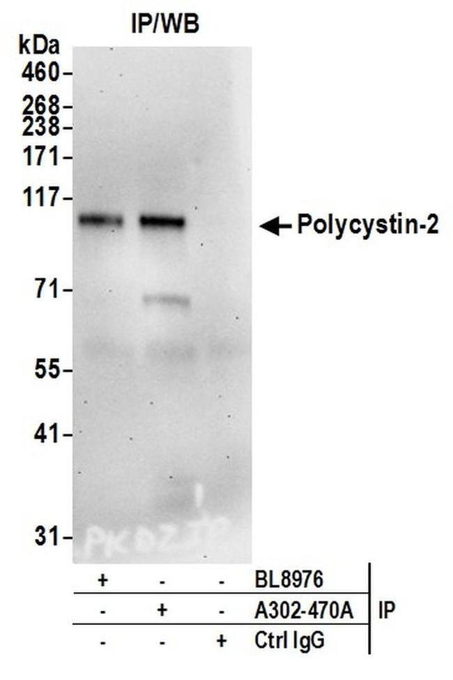 Polycystin-2 Antibody in Western Blot (WB)