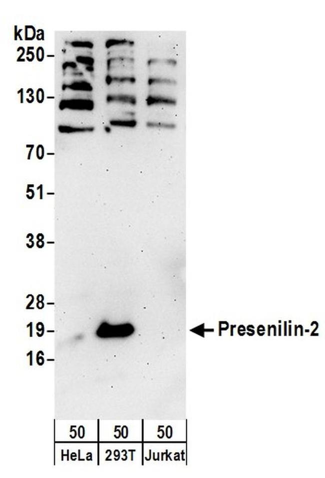 Presenilin-2 Antibody in Western Blot (WB)