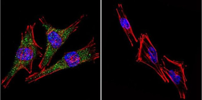 PSEN2 Antibody in Immunocytochemistry (ICC/IF)