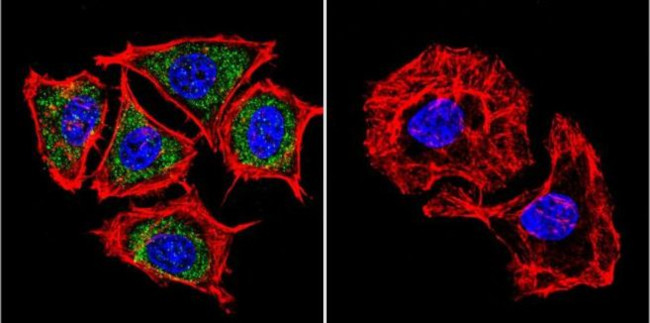 PSEN2 Antibody in Immunocytochemistry (ICC/IF)