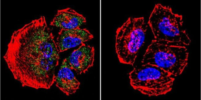 PSEN2 Antibody in Immunocytochemistry (ICC/IF)