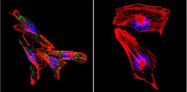 PSEN2 Antibody in Immunocytochemistry (ICC/IF)