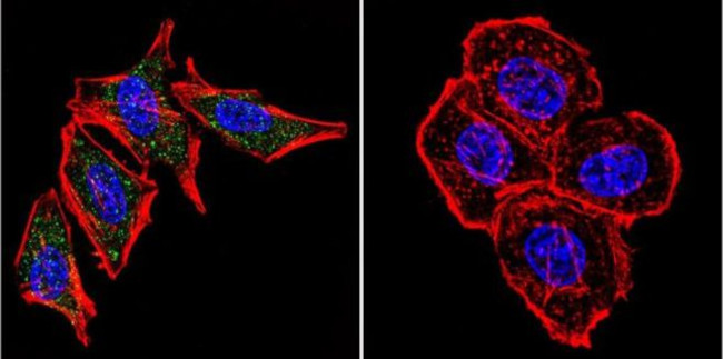 PSEN2 Antibody in Immunocytochemistry (ICC/IF)