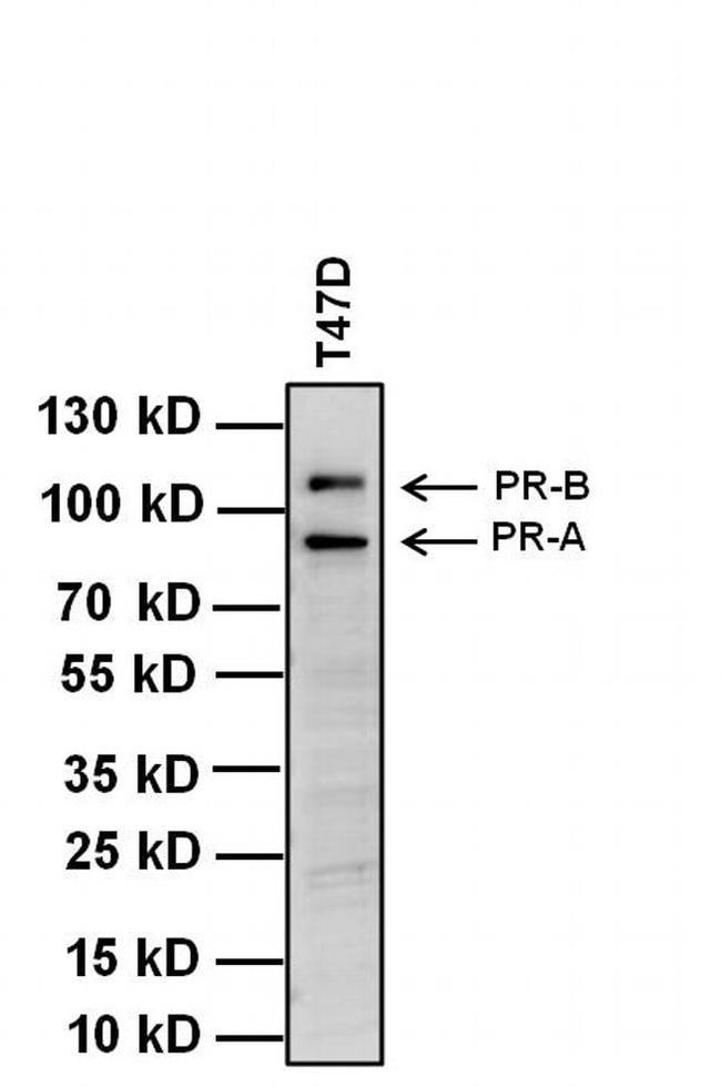 Progesterone Receptor Antibody in Western Blot (WB)