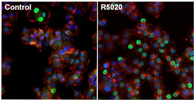 Progesterone Receptor Antibody in Immunocytochemistry (ICC/IF)