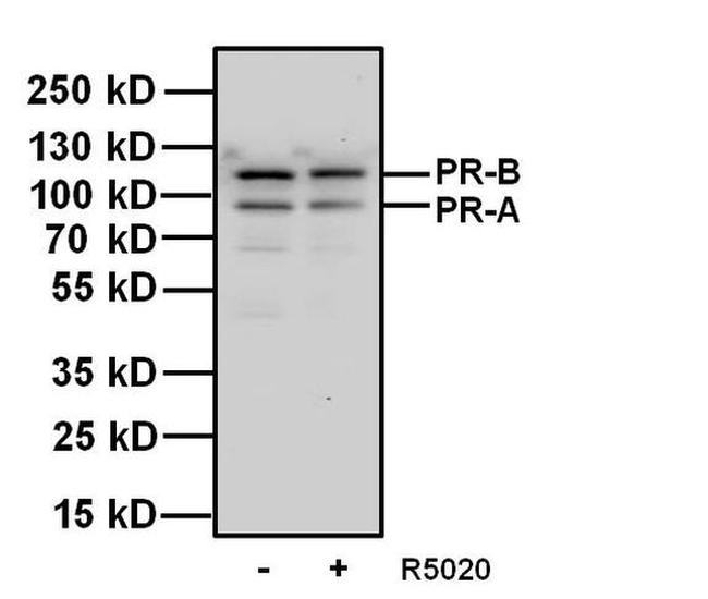 Progesterone Receptor Antibody in Western Blot (WB)