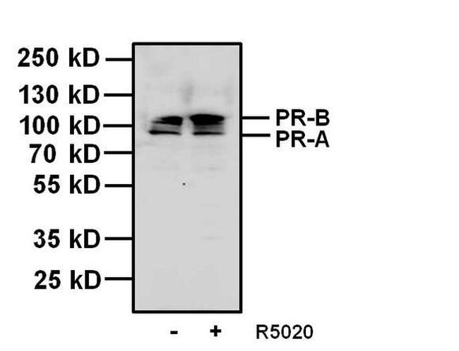 Progesterone Receptor Antibody in Western Blot (WB)