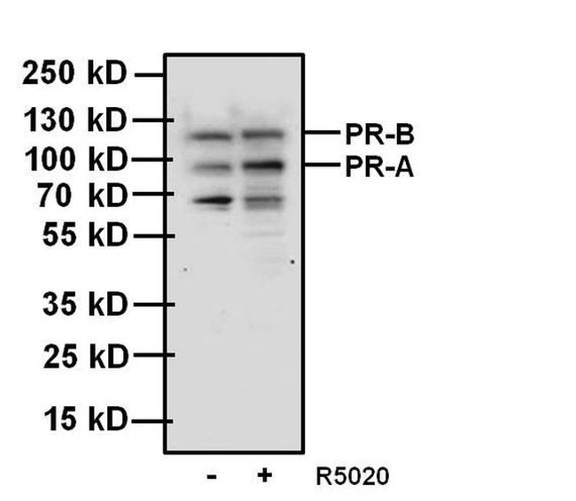 Progesterone Receptor Antibody in Western Blot (WB)