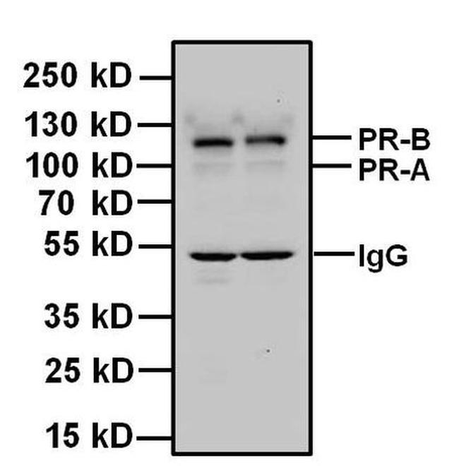 Progesterone Receptor Antibody in Western Blot (WB)