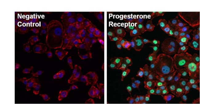 Progesterone Receptor Antibody in Immunocytochemistry (ICC/IF)