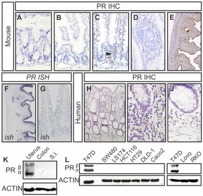 Progesterone Receptor Antibody in Western Blot, Immunohistochemistry (WB, IHC)