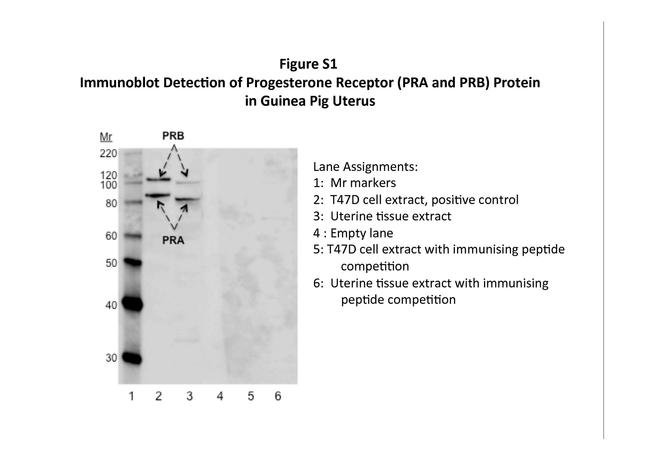 Progesterone Receptor Antibody in Western Blot (WB)