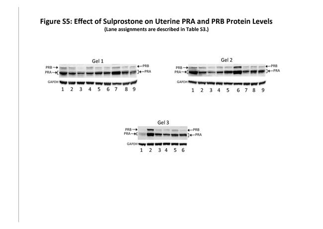 Progesterone Receptor Antibody in Western Blot (WB)