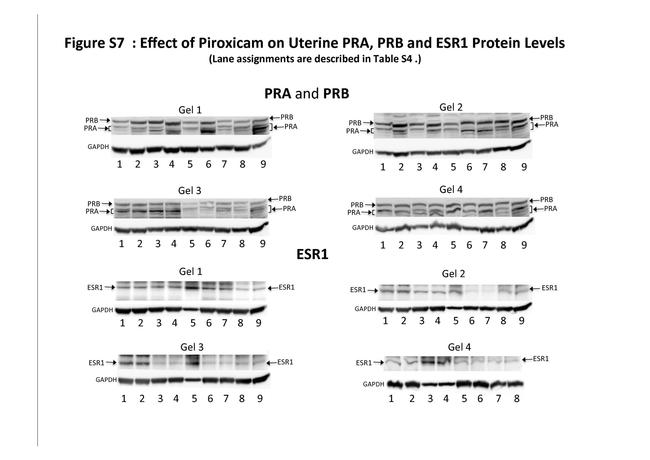 Progesterone Receptor Antibody in Western Blot (WB)