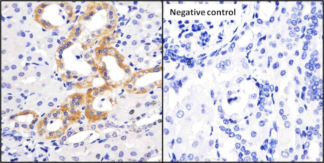 Progranulin Antibody in Immunohistochemistry (IHC)