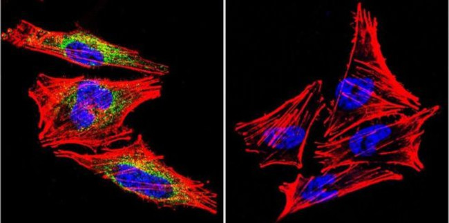 Prolactin Receptor Antibody in Immunocytochemistry (ICC/IF)