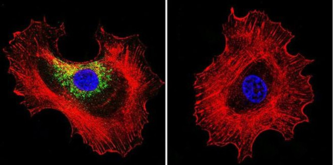 Prolactin Receptor Antibody in Immunocytochemistry (ICC/IF)