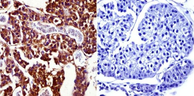 Prolactin Receptor Antibody in Immunohistochemistry (Paraffin) (IHC (P))