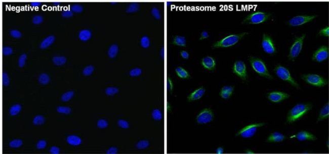 PSMB8 Antibody in Immunocytochemistry (ICC/IF)