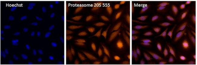 PSMB6 Antibody in Immunocytochemistry (ICC/IF)