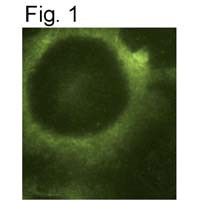 PSEN2 Antibody in Immunocytochemistry (ICC/IF)