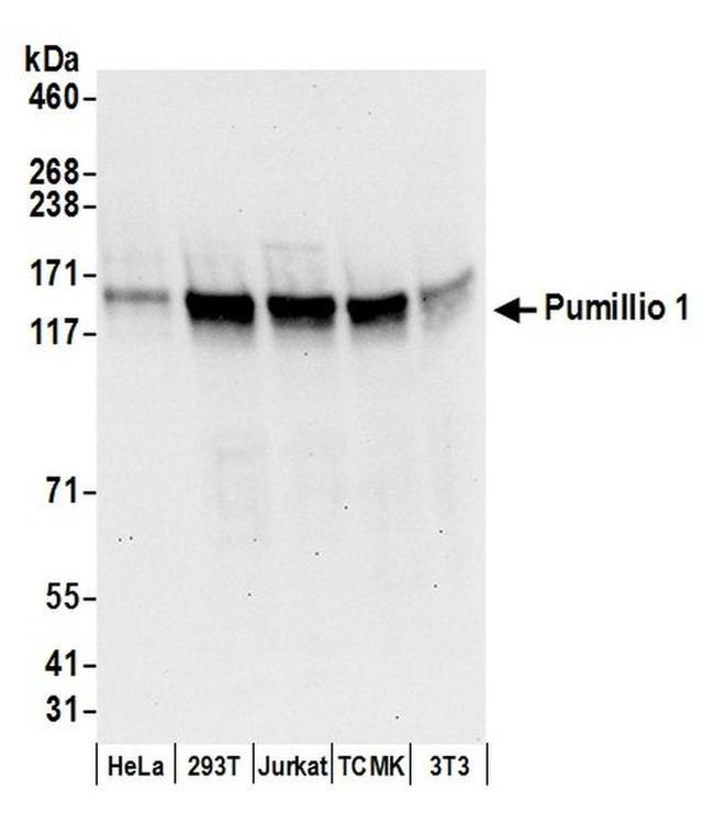 Pumilio 1 Antibody in Western Blot (WB)