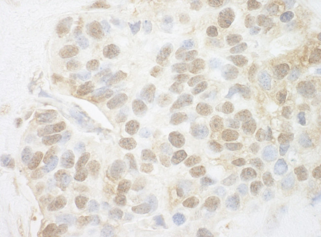 Pygo2 Antibody in Immunohistochemistry (IHC)