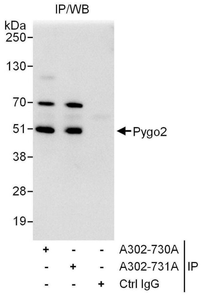 Pygo2 Antibody in Immunoprecipitation (IP)