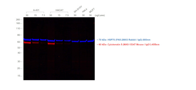 Mouse IgG (H+L) Secondary Antibody in Western Blot (WB)